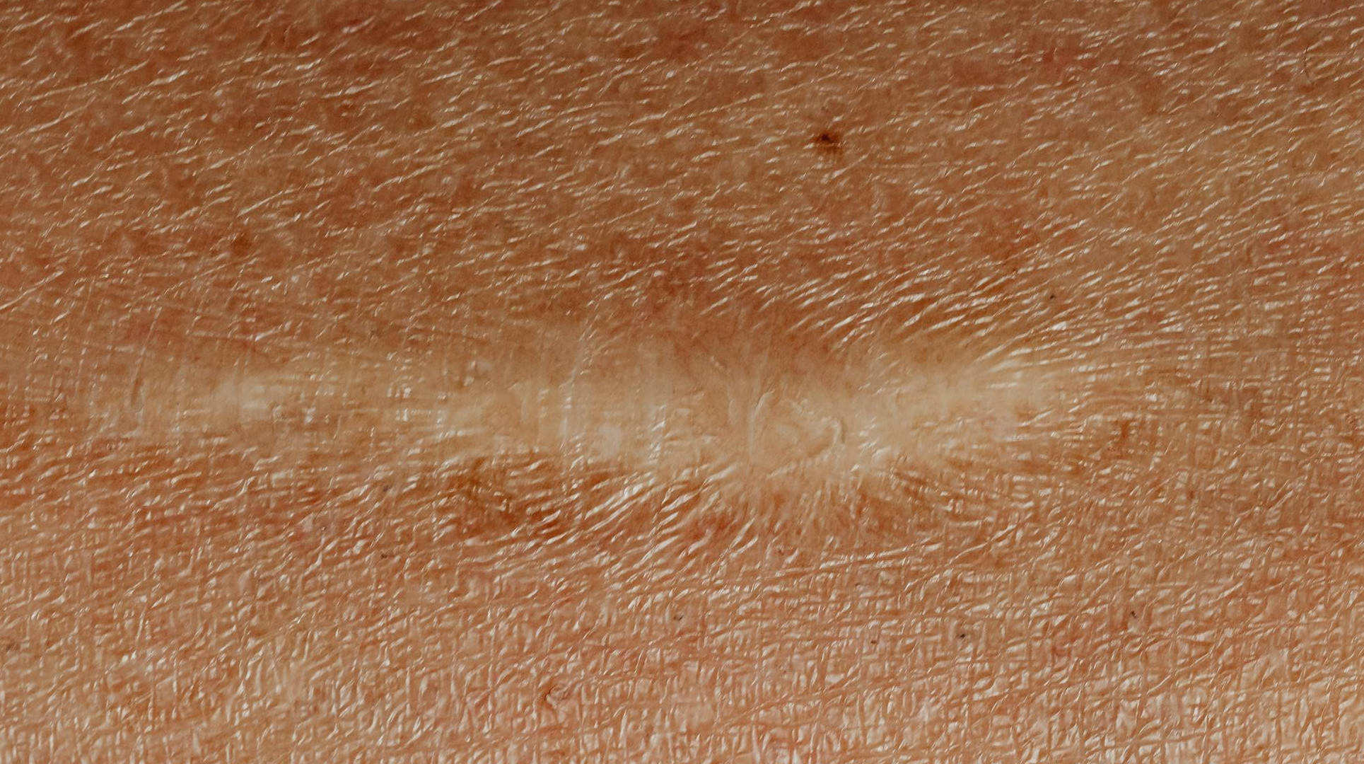 Old Scar