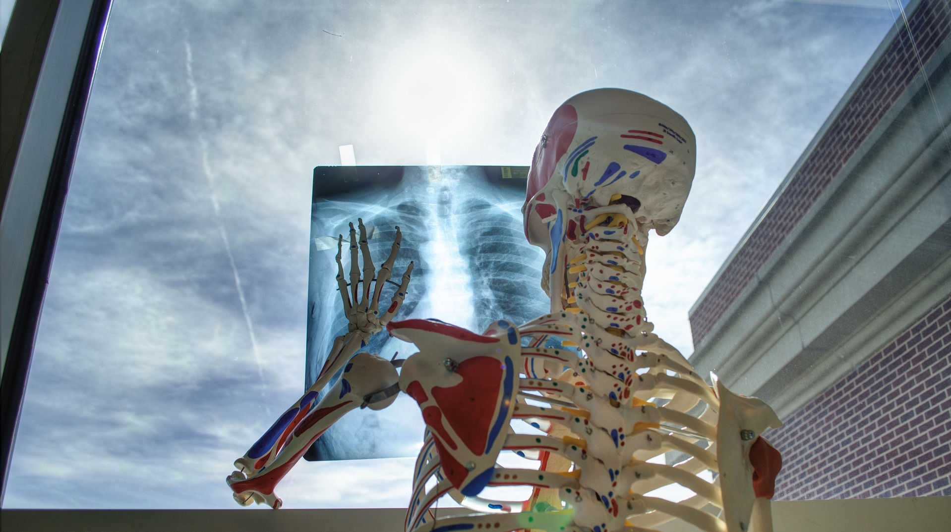 Image of skeleton looking at xray of bones