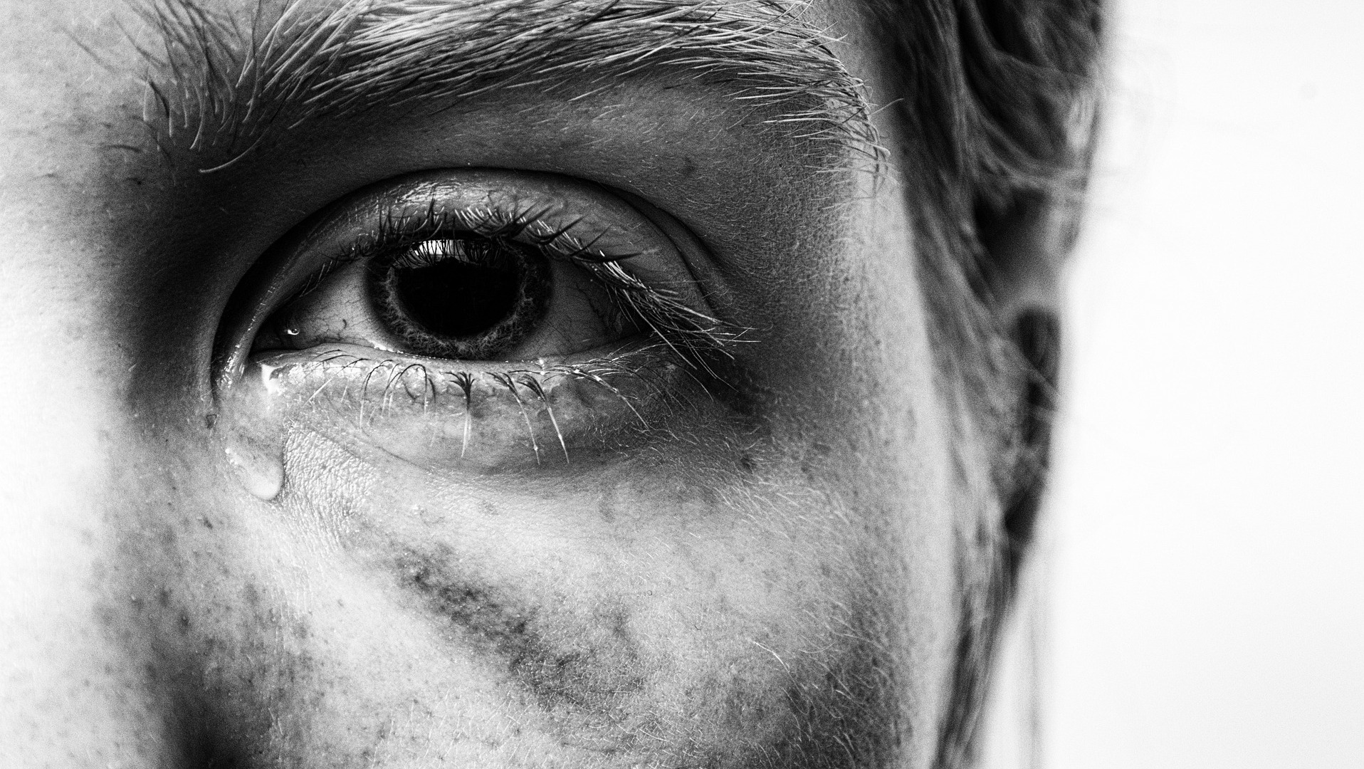 Bruised Black Eye